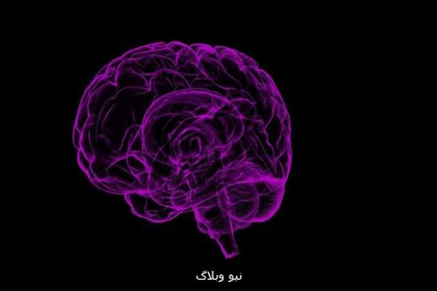 اندازه گیری فشار مایع مغزی نخاعی با روشی جدید
