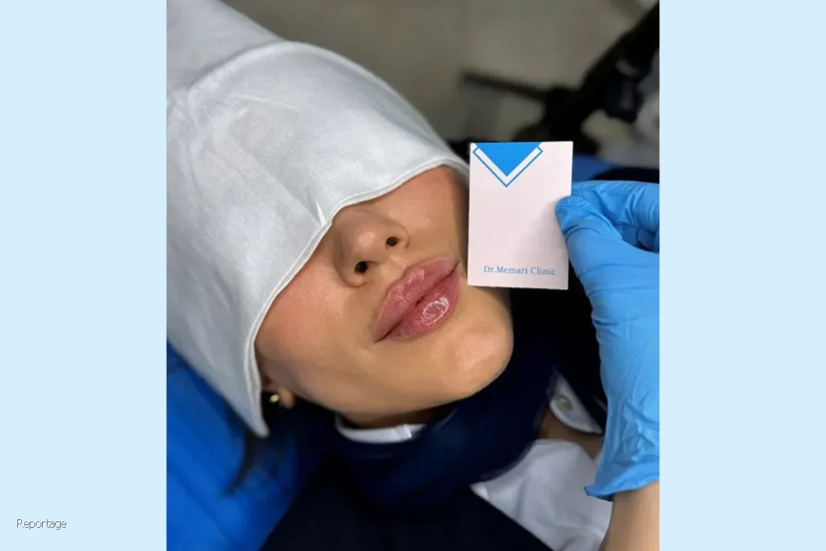 استفاده از فیلر لب چه تاثیری در زیبایی صورت دارد؟