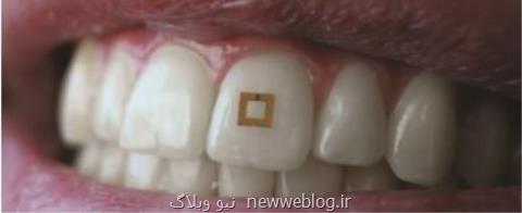 سنسوری كه مراقب غذای شماست!