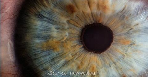 ۴ نوآوری پزشكی كه شاید نابینایی را درمان كنند