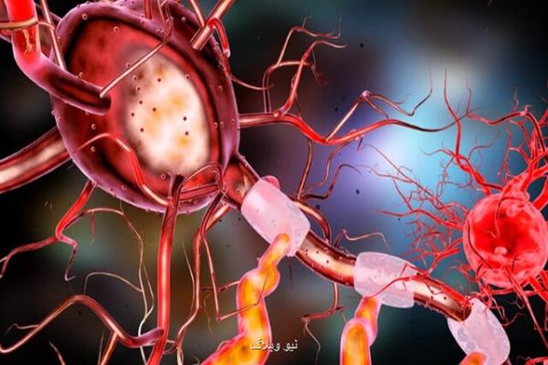شناسایی فرآیندی كه در بروز بیماری آلزایمر موثر است
