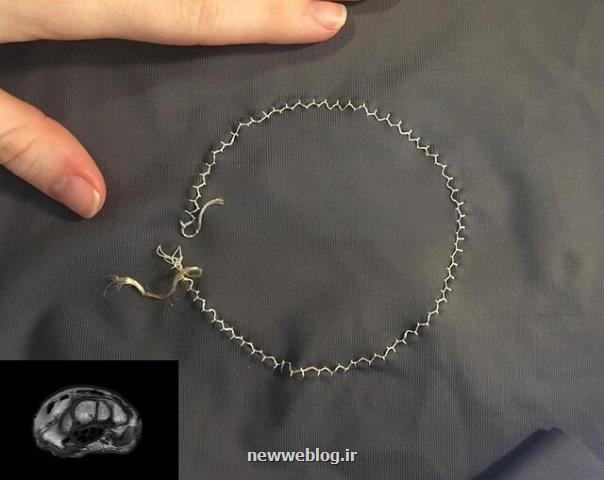 بهبود آزمایش ام آر آی با كمك یك ابزار پوشیدنی