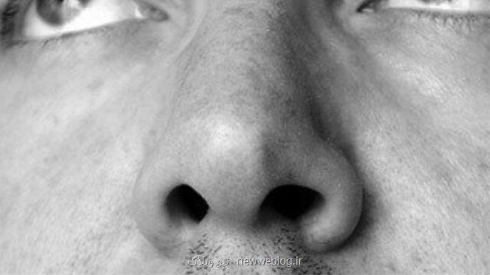 ارتباط اختلال عملكرد بویایی و بیماری پاركینسون