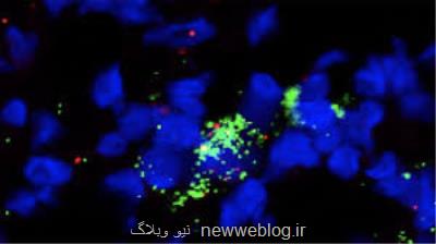 دارویی كه توانایی سیستم ایمنی را در مقابله با سرطان 2 برابر می كند